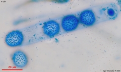 Scutellinia minor