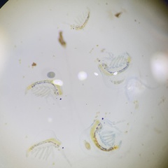 Holopedium gibberum