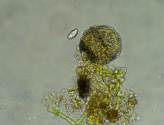 Cercozoa
