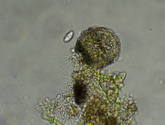 Cercozoa