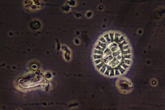 Pseudopediastrum boryanum