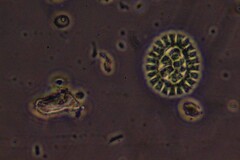 Pseudopediastrum boryanum