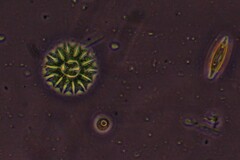 Pseudopediastrum boryanum