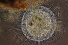 Actinosphaerium