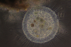 Actinosphaerium