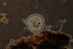 Actinosphaerium
