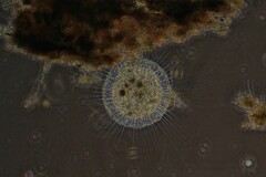 Actinosphaerium