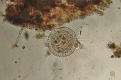 Actinosphaerium