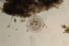 Actinosphaerium