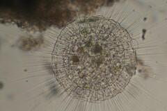 Actinosphaerium