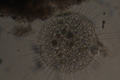 Actinosphaerium