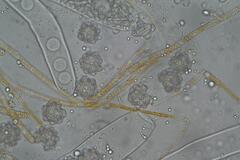 Octospora maireana