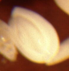 Quinqueloculina seminulum