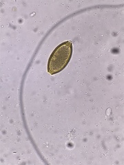 Trichuris vulpis