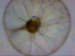 Noctiluca scintillans