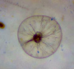 Noctiluca scintillans