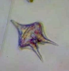 Protoperidinium