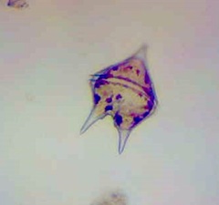 Protoperidinium