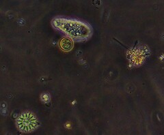 Pseudopediastrum boryanum