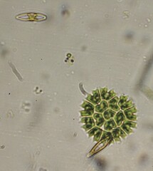 Pseudopediastrum boryanum