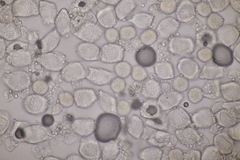 Puccinia circaeae-caricis