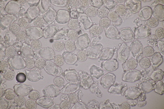 Puccinia circaeae-caricis