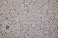 Puccinia circaeae-caricis