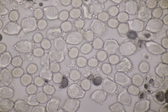 Puccinia circaeae-caricis