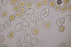 Puccinia alnetorum