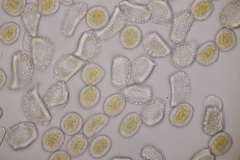 Puccinia alnetorum