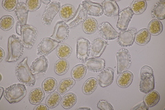 Puccinia alnetorum