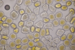 Puccinia alnetorum