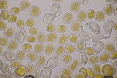 Puccinia alnetorum