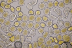 Puccinia alnetorum