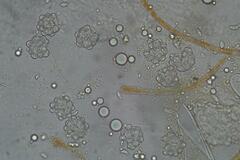 Octospora maireana