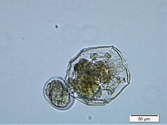 Brachionus angularis