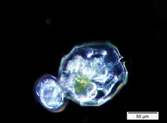 Brachionus angularis