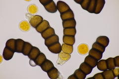 Xenodochus carbonarius