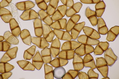Puccinia astrantiae