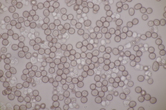 Microbotryum silenes-dioicae