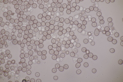 Microbotryum silenes-dioicae