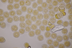 Puccinia willemetiae