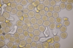 Puccinia willemetiae