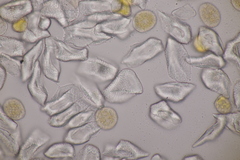 Puccinia willemetiae