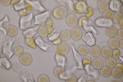 Puccinia willemetiae