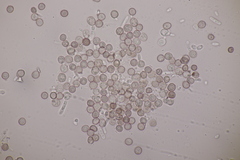 Microbotryum superbum