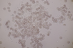 Microbotryum superbum