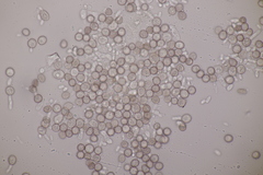 Microbotryum superbum