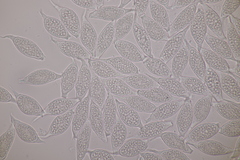 Uredinopsis filicina