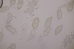 Puccinia salviae